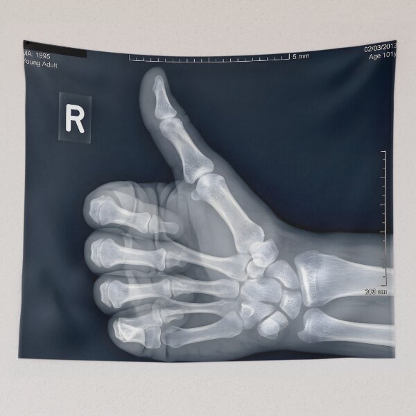 Item preview, Thumbs Up Hand X-Ray Skeleton Gesture designed and sold by Sybille-Yates.