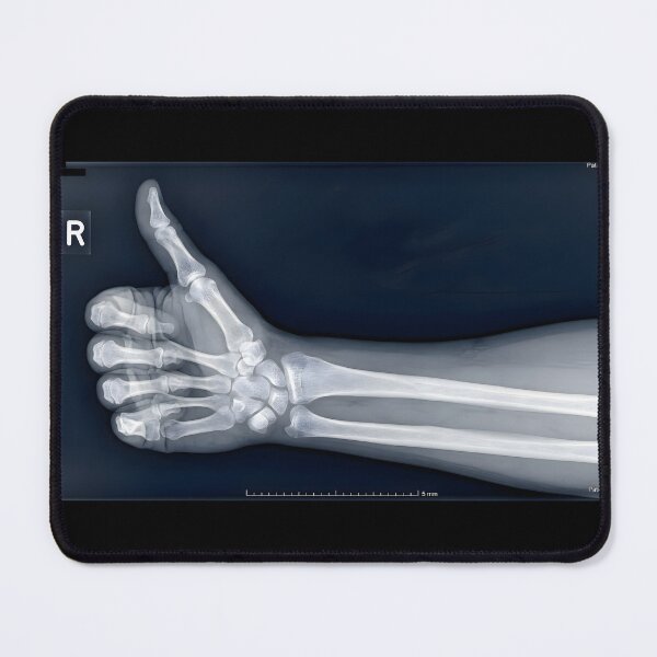 Item preview, Thumbs Up Hand X-Ray Skeleton Gesture designed and sold by Sybille-Yates.