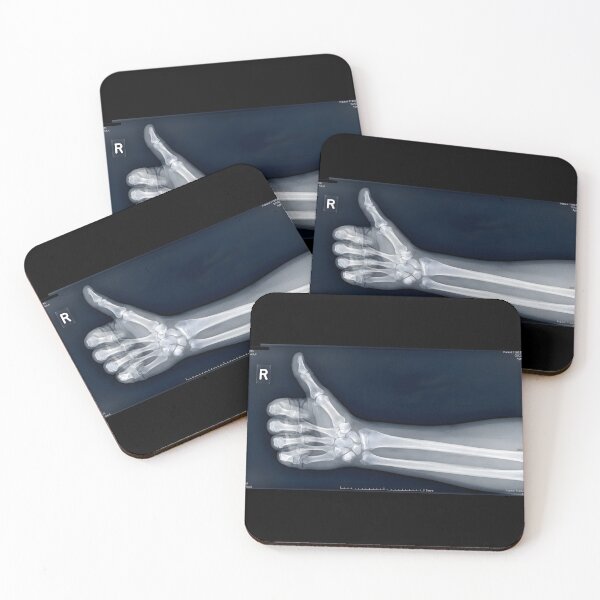 Item preview, Thumbs Up Hand X-Ray Skeleton Gesture designed and sold by Sybille-Yates.