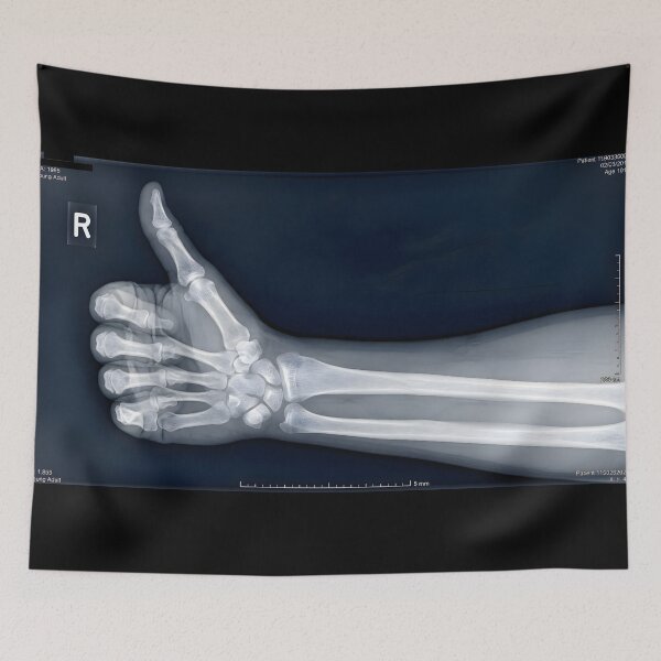 Item preview, Thumbs Up Hand X-Ray Skeleton Gesture designed and sold by Sybille-Yates.