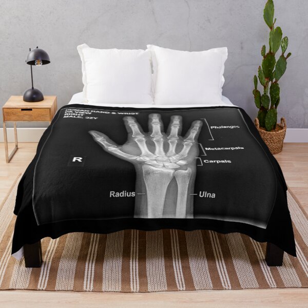 Item preview, X-ray anatomy of the bones of a hand. designed and sold by Giulivo Store Graphic.