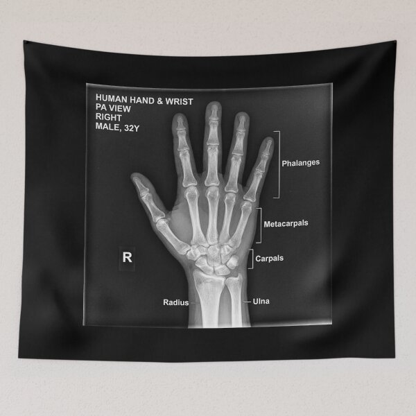 Item preview, X-ray anatomy of the bones of a hand. designed and sold by Giulivo Store Graphic.