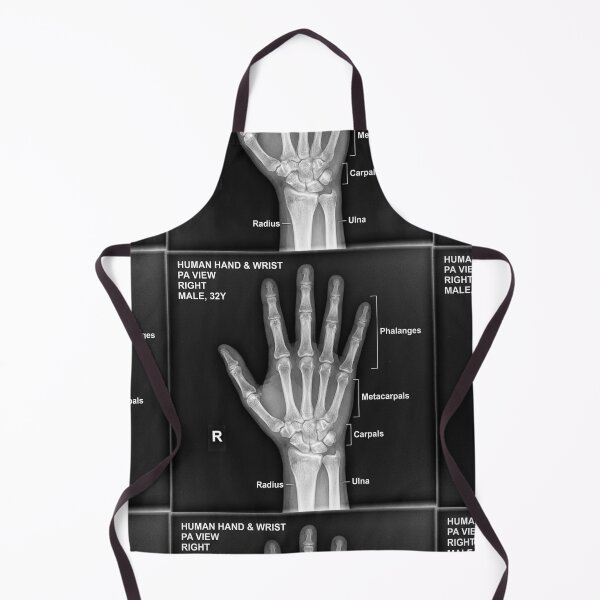Item preview, X-ray anatomy of the bones of a hand. designed and sold by Giulivo Store Graphic.