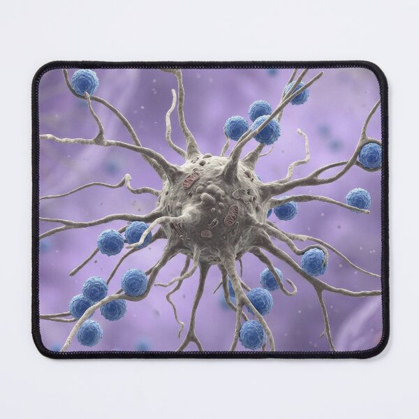 Item preview, Neuron Like Cell With Blue Lymphocytes designed and sold by KaiWaiGallery.