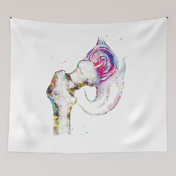 Item preview, Hip joint designed and sold by Liededrom..