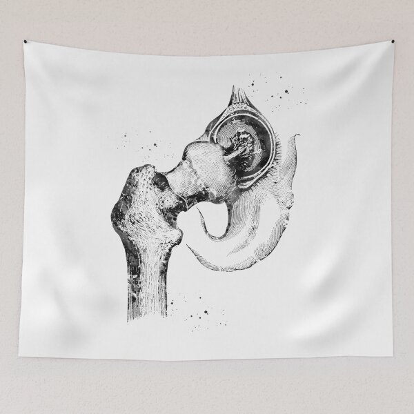 Item preview, Hip joint designed and sold by Liededrom..