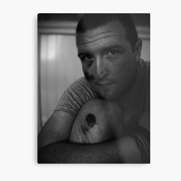 Road Rash Metal Print