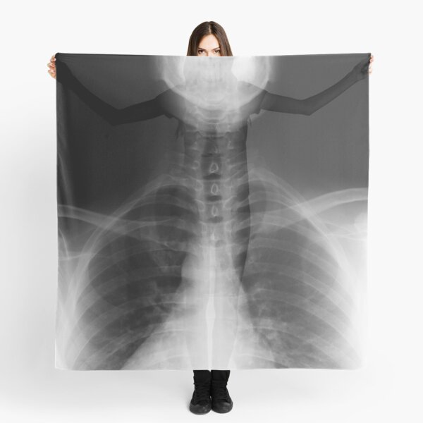 Item preview, X-Ray: Chest and Lower Jaw designed and sold by 4HornCreative.