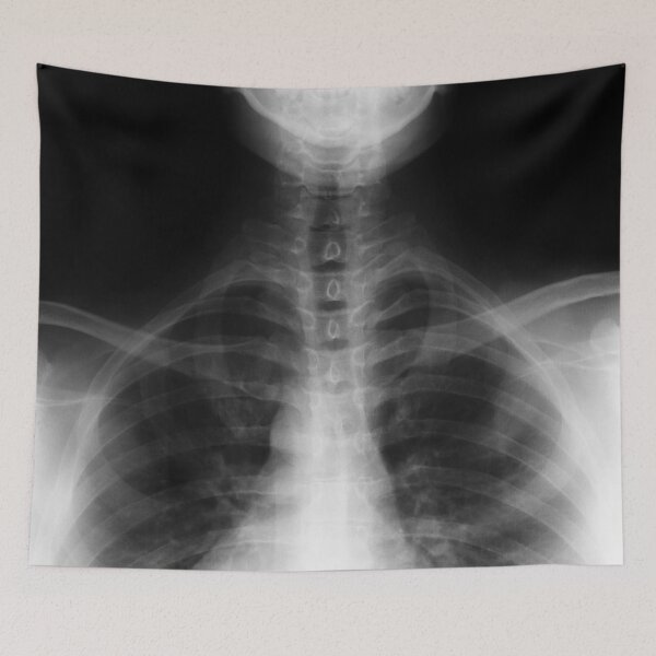 Item preview, X-Ray: Chest and Lower Jaw designed and sold by 4HornCreative.