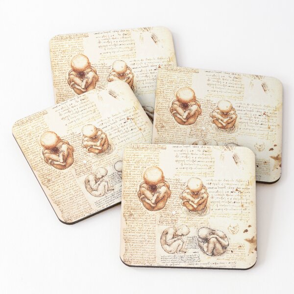 Item preview, Views of a Fetus in the Womb,Ob-Gyn Medical designed and sold by BulganLumini.