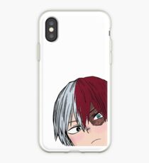 Shoto Todoroki My Hero Academia iPhone Case