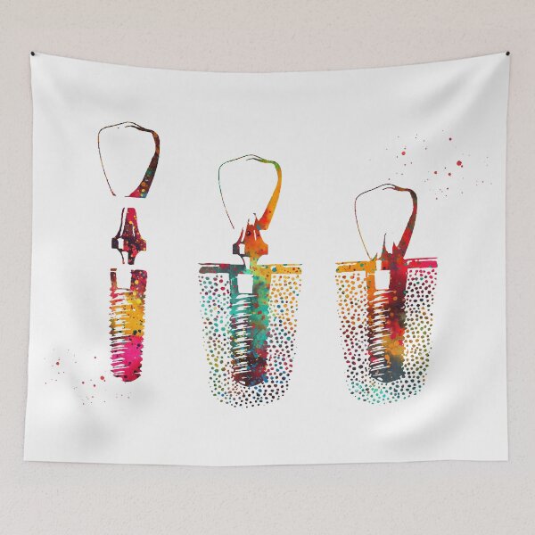 Item preview,  Dental implant procedure designed and sold by Liededrom..