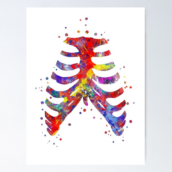 Medical illustration detailing thoracic outlet syndrome. Poster