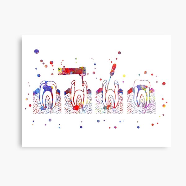 Item preview, The root canal therapy, the root canal, root canal treatment designed and sold by Rosaliartbook.