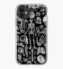 Human Anatomy Black Print iPhone Case