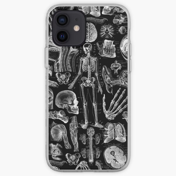 Human Anatomy Black Print iPhone Soft Case