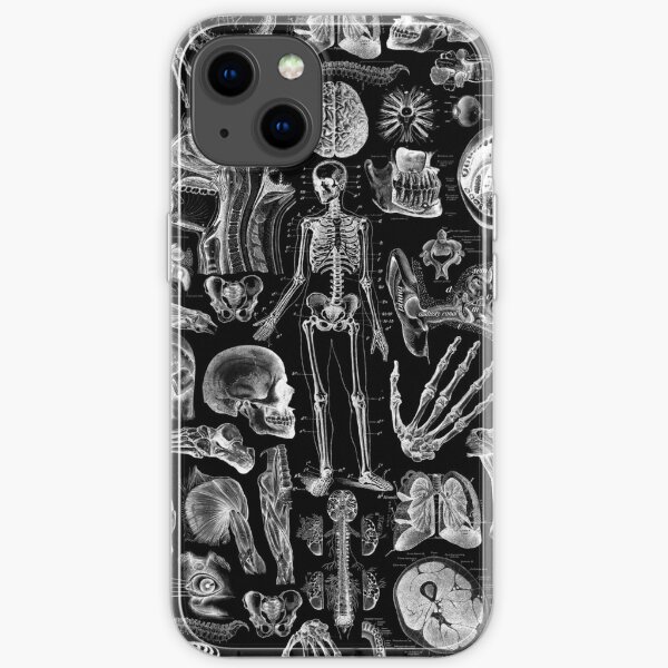 Human Anatomy Black Print iPhone Soft Case