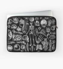 Funda para portátil Anatomía Humana Black Print