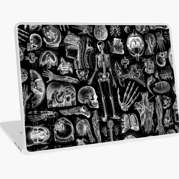 Human Anatomy Black Print Laptop Skin
