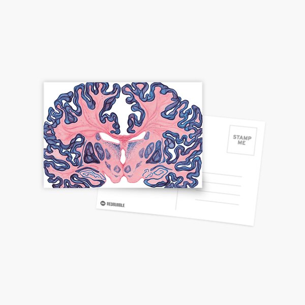 Item preview, Gyri and Swirls of Human Brain designed and sold by Heatherbondi.