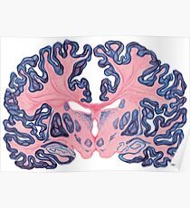Póster Gyri y remolinos del cerebro humano