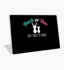 Gender Reveal Party Gift Daddy New Baby Boy Girl Laptop Skin