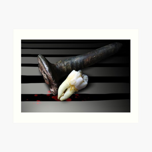 Tooth and Nail - #1 Dental Series Art Print