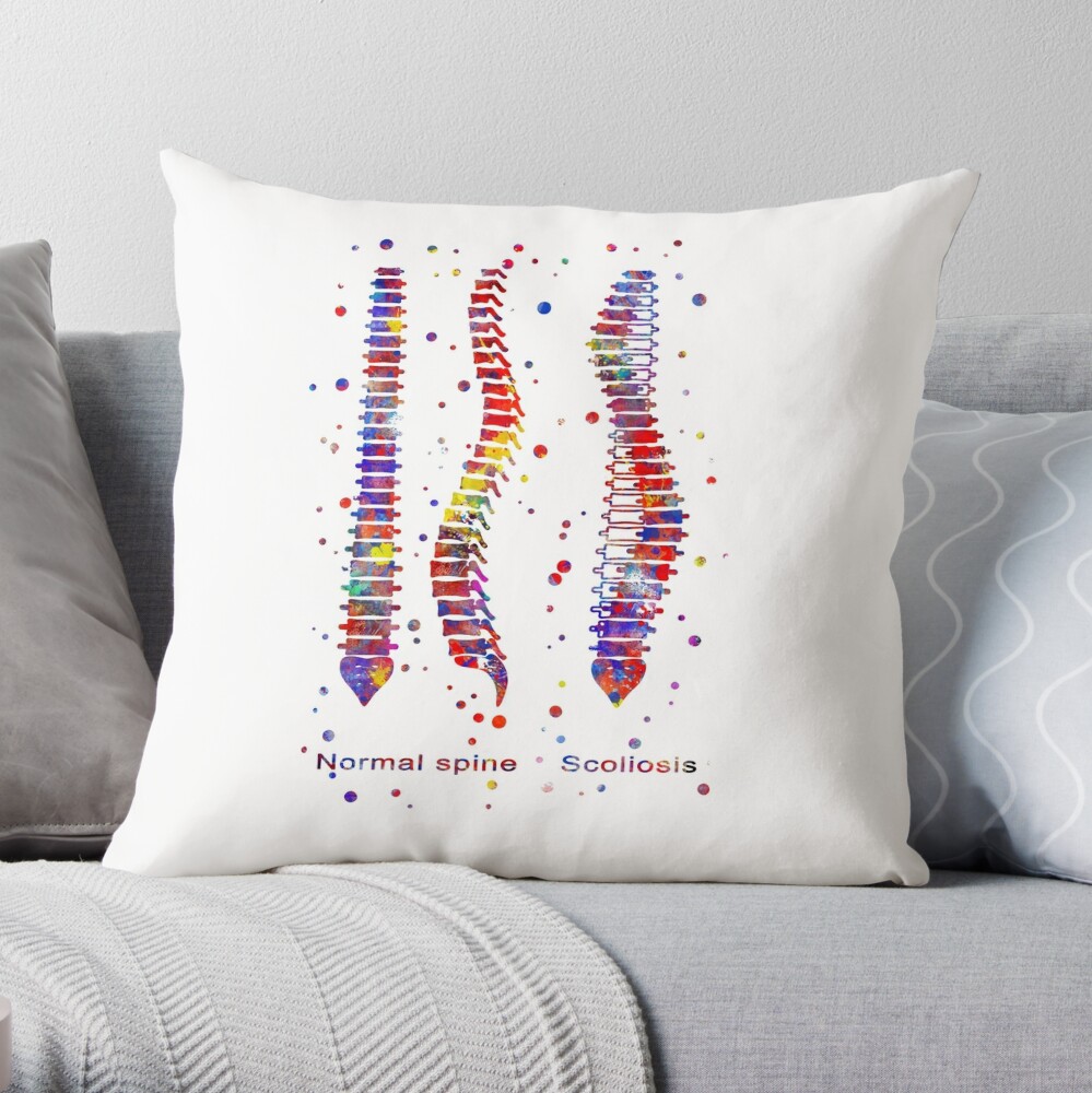Type of scoliosis of spine Throw Pillow for Sale by Rosaliartbook