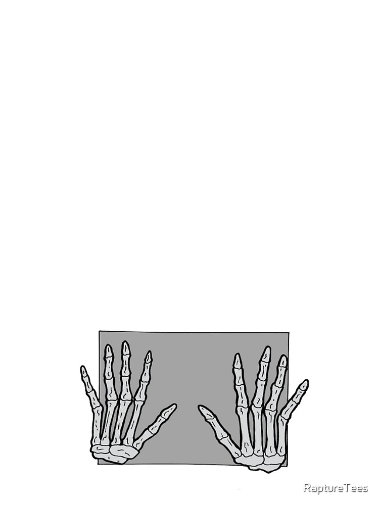 Thumbnail 4 of 4, iPhone Case, Skeletal Hands - Rapture Merch designed and sold by RaptureTees.