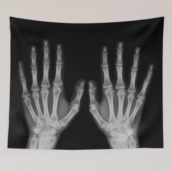 Item preview, X-Ray Human Hands 1 designed and sold by avidfan2000.
