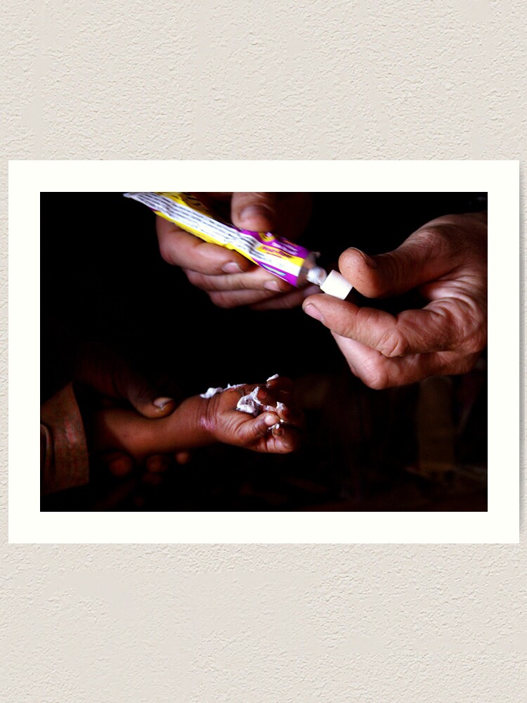 Alternate view of Healing Hands in Rajasthan, India Art Print