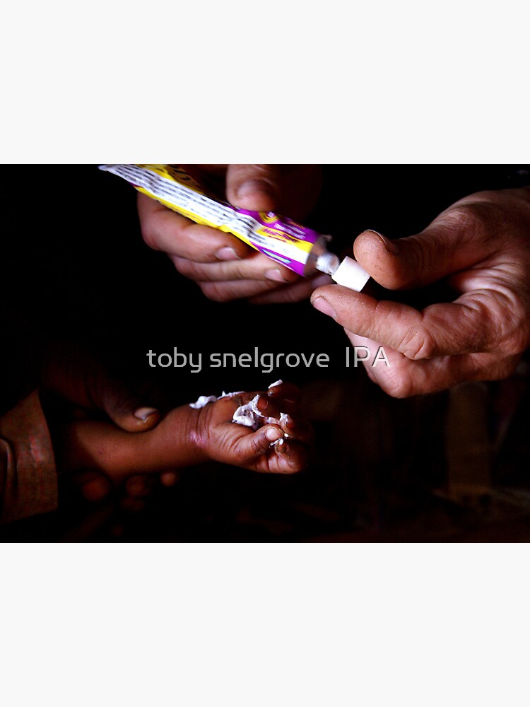 Healing Hands in Rajasthan, India by tobysnelgrove