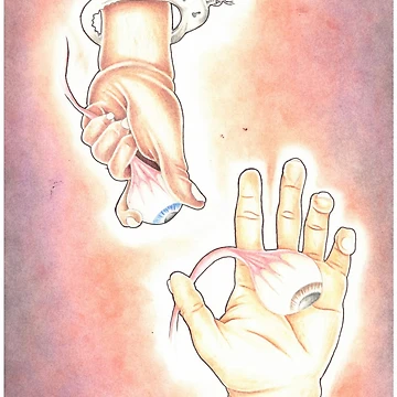 Artwork thumbnail, "Hey, you dropped your eye" by Andrew Krease