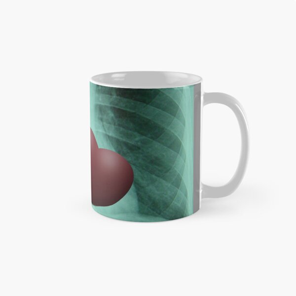Item preview, Radiology designed and sold by masterchef-fr.