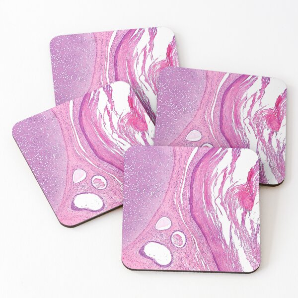 Item preview, Teratoma Histology designed and sold by deltoid.