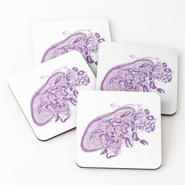 Item preview, Uterus Histology designed and sold by deltoid.