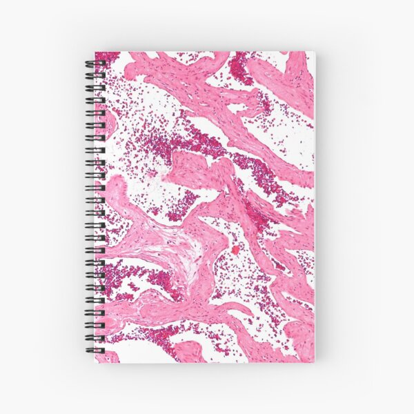 Liver Disease Histology Spiral Notebook