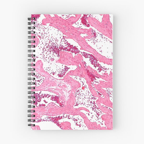 Item preview, Liver Disease Histology designed and sold by deltoid.