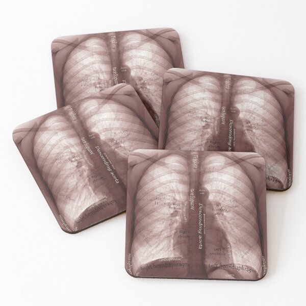 Item preview, X ray designed and sold by IschemicNeuron.