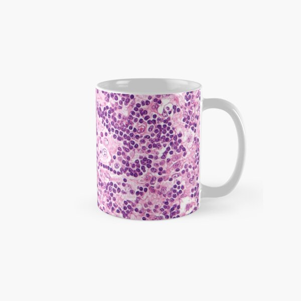 Lymph Node Histology Classic Mug