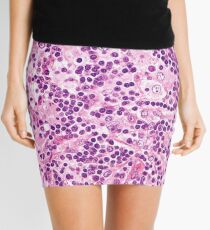 Lymph Node Histology Mini Skirt