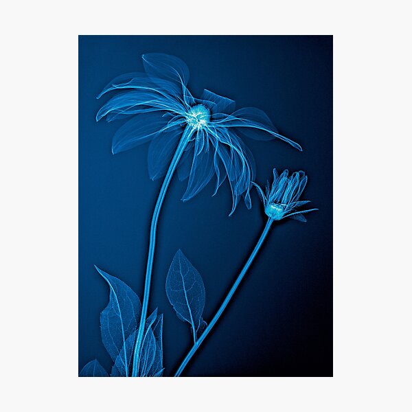 Item preview, X-rayed golden daisy flower  designed and sold by Lanuma.
