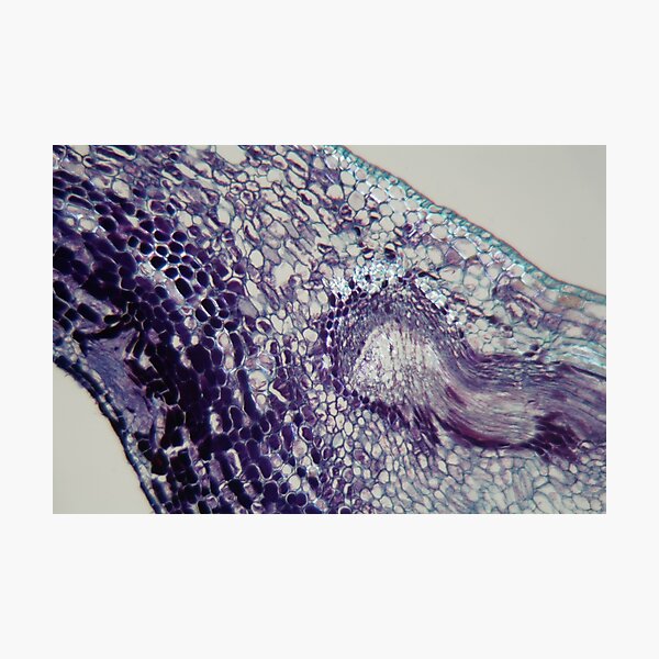 Item preview, Plant cells infected by a plant parasite under the microscope. designed and sold by Zosimus.