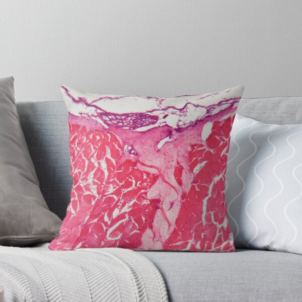 Item preview, Cells of a fish skin injured by chemicals under the microscope. designed and sold by Zosimus.