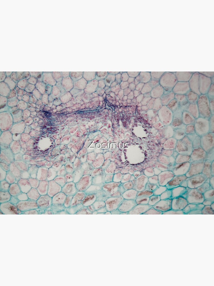 célula animal vs célula vegetal bajo microscopio