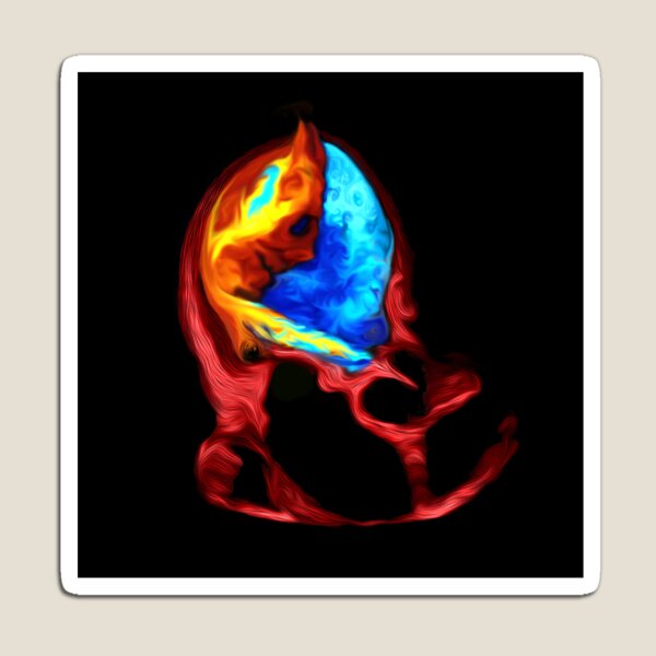 Item preview, Devilish aortic regurgitation designed and sold by EchoArtUK.