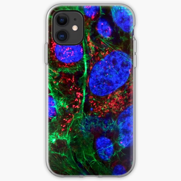Cell biology art - nucleus and mitochondria - immune histology fluorescence iPhone Soft Case