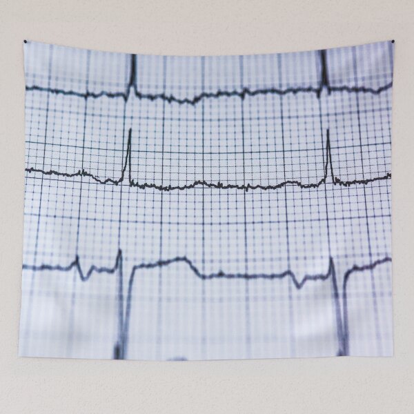 Item preview, fwc 1393 blur chart check up designed and sold by fred chiea.