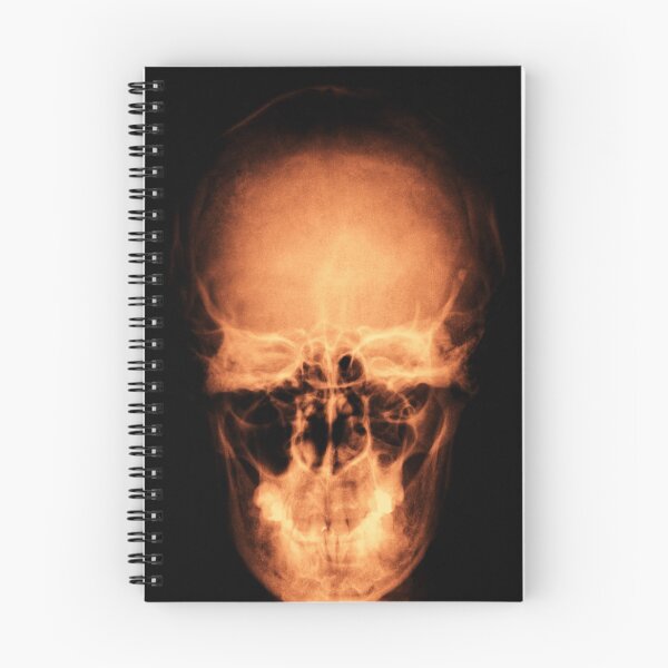 Item preview, skull head burning  x-ray designed and sold by Claraveritas.