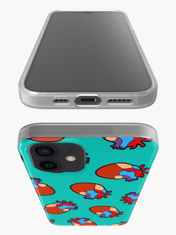 Alternate view of Anatomical Heart Pattern iPhone Case & Cover
